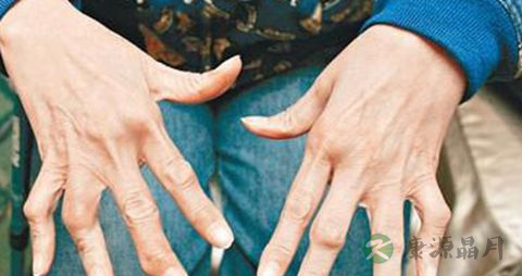 类风湿病人吃什么食物 类风湿病人吃什么食物