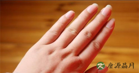 如何解决冬季手脚脱皮 如何解决冬季手脚脱皮