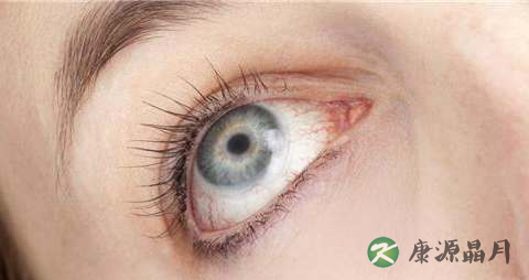 眼角膜受损怎么办 眼角膜受损怎么办