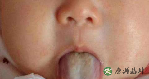 舌苔黄厚怎么回事 舌苔黄厚怎么回事