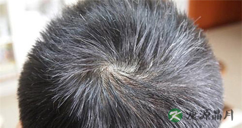 结肠腺癌怎么治疗 结肠腺癌怎么治疗