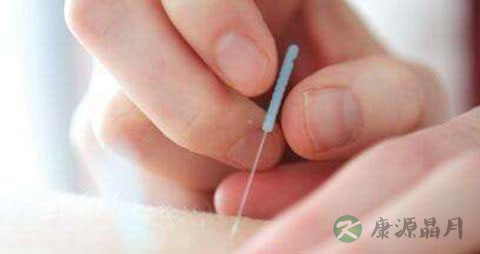 针灸后注意事项 针灸后注意事项