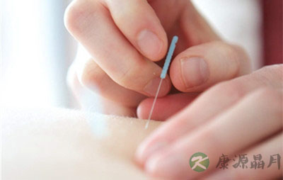 腰疼针灸什么穴位 腰疼针灸什么穴位