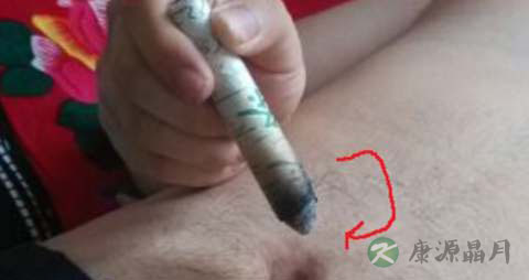 艾灸肚脐不出水怎么回事 艾灸肚脐不出水怎么回事