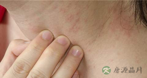 甲状腺肿大治疗偏方 甲状腺肿大治疗偏方
