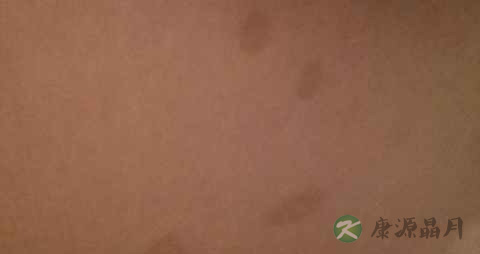 什么是花斑疹 什么是花斑疹