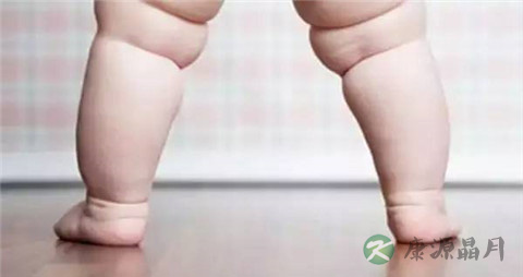 婴儿血管瘤中药食疗 婴儿血管瘤中药食疗