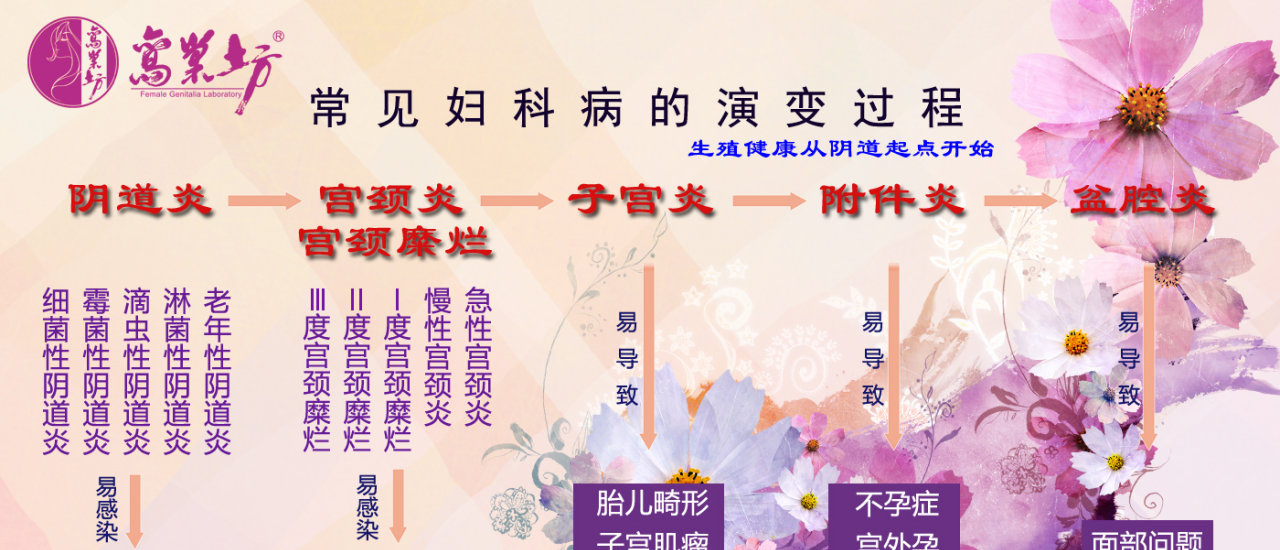 女性卵巢的保养方法 女性卵巢的保养方法
