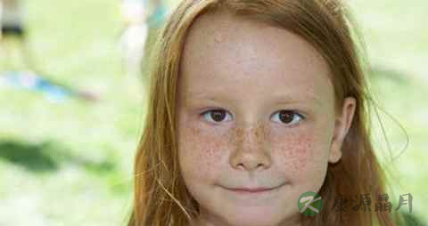 小孩脸上长雀斑吃什么 小孩脸上长雀斑吃什么