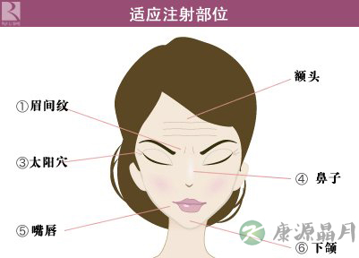 揭开玻尿酸“青春不老”的秘密 揭开玻尿酸“青春不老”的秘密