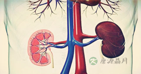 肾积水 肾积水
