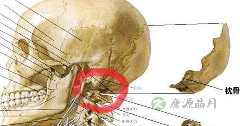 落枕 落枕
