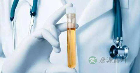 尿分叉 尿分叉
