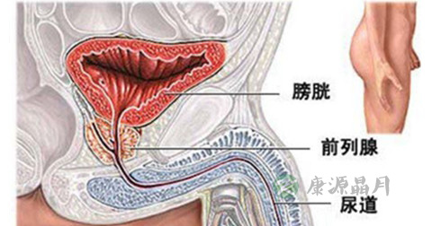 生殖器疱疹 生殖器疱疹