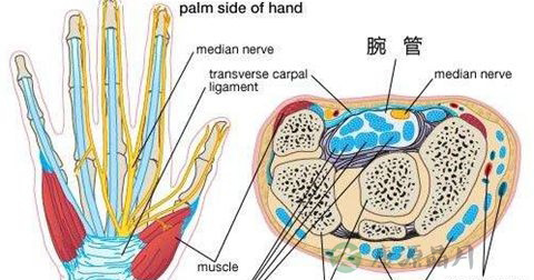 腕管综合征 腕管综合征