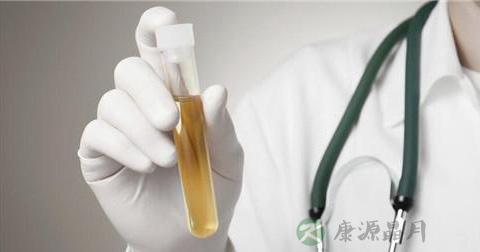 血友病 血友病