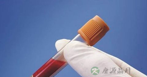 阿-曼氏试验 阿-曼氏试验