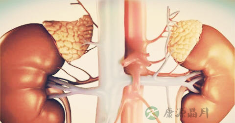肾积水 肾积水