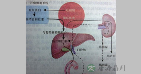 黄疸 黄疸