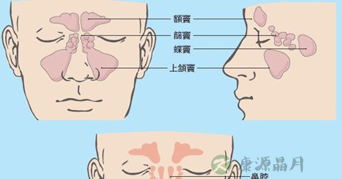 过敏性鼻炎 过敏性鼻炎