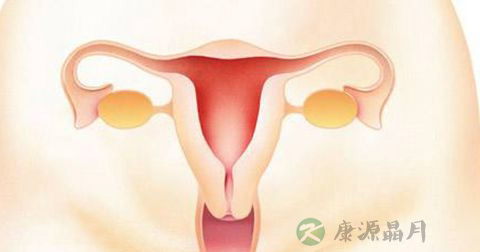 盆腔炎 盆腔炎
