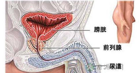 睾丸癌 睾丸癌