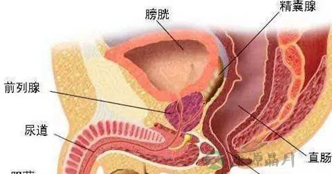 尿道狭窄