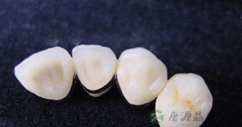 烤瓷粉 烤瓷粉