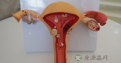 多囊卵巢 多囊卵巢