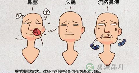 鼻窦炎 鼻窦炎