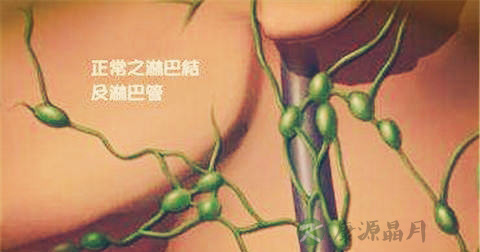 淋巴瘤 淋巴瘤