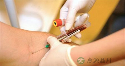 红细胞沉降率 红细胞沉降率