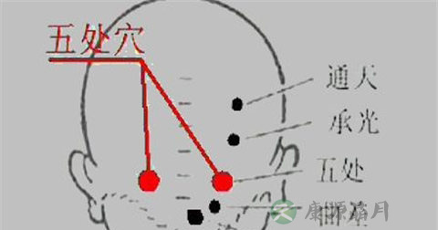 五处穴 五处穴