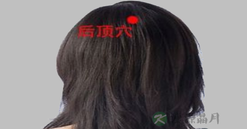 后顶穴 后顶穴