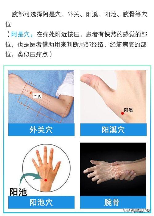 门诊干货|针灸治疗类风湿关节炎配穴