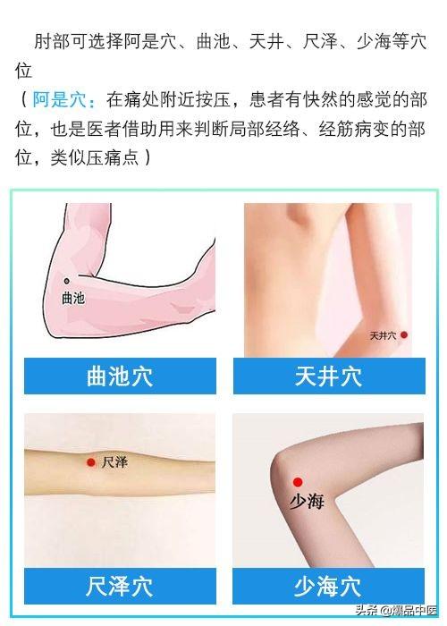 门诊干货|针灸治疗类风湿关节炎配穴