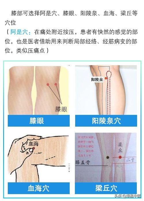 门诊干货|针灸治疗类风湿关节炎配穴