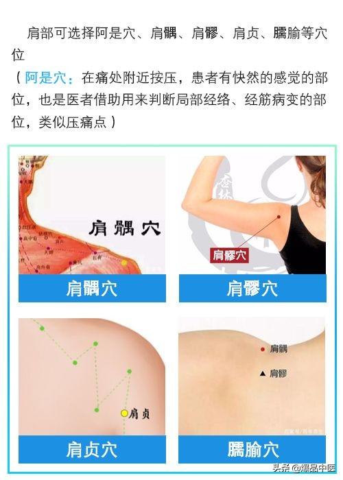 门诊干货|针灸治疗类风湿关节炎配穴