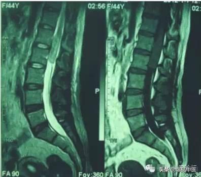 超级实用的腰腿痛临床诊断思维,值得收藏