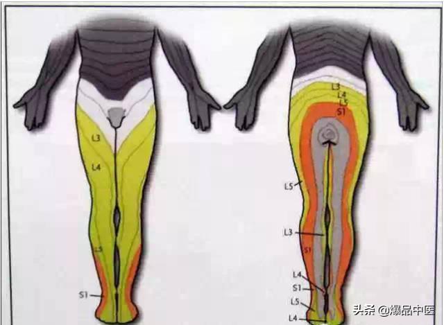 超级实用的腰腿痛临床诊断思维,值得收藏