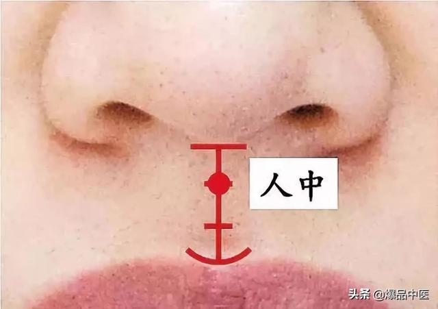 经典图文:治痛25套中医对穴组合