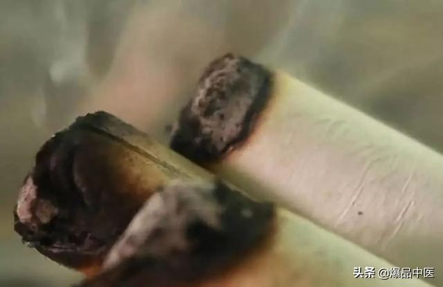 收藏,最全艾灸配穴,让你艾灸不求人