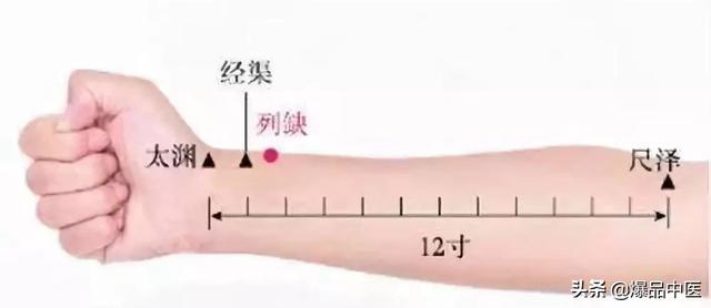 经典图文:治痛25套中医对穴组合
