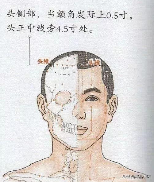 经典图文:治痛25套中医对穴组合