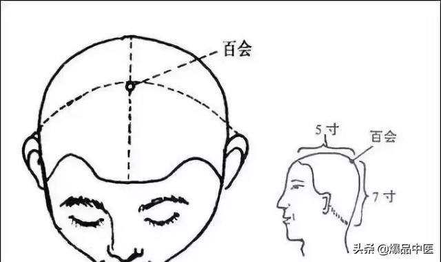 经典图文:治痛25套中医对穴组合