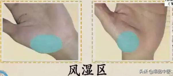 手是健康的镜子，10种常见病，从手上就能看出来