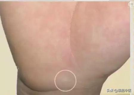 手是健康的镜子，10种常见病，从手上就能看出来