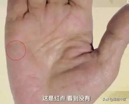 手是健康的镜子，10种常见病，从手上就能看出来