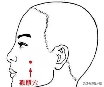 面瘫,可以选这些穴位治疗