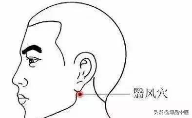 面瘫,可以选这些穴位治疗